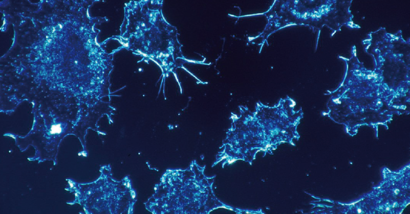 CIK、DC/CIK(PB)技术